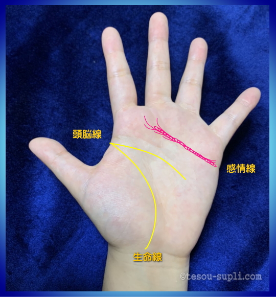 音楽の才能を示す手相ー感情線が鎖状か支線が多い