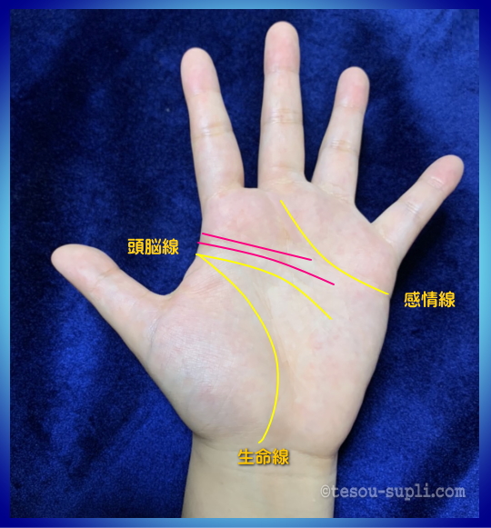 音楽の才能を示す手相ー頭脳線の上に定規でひいたような線がある